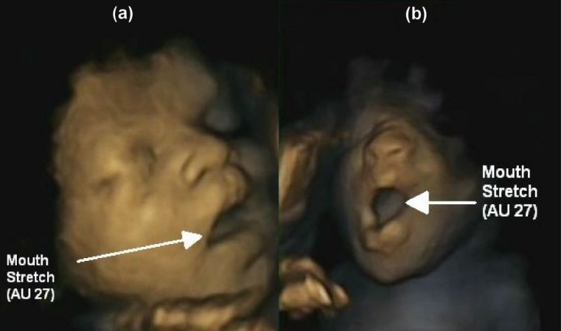 sbadiglio-feto
