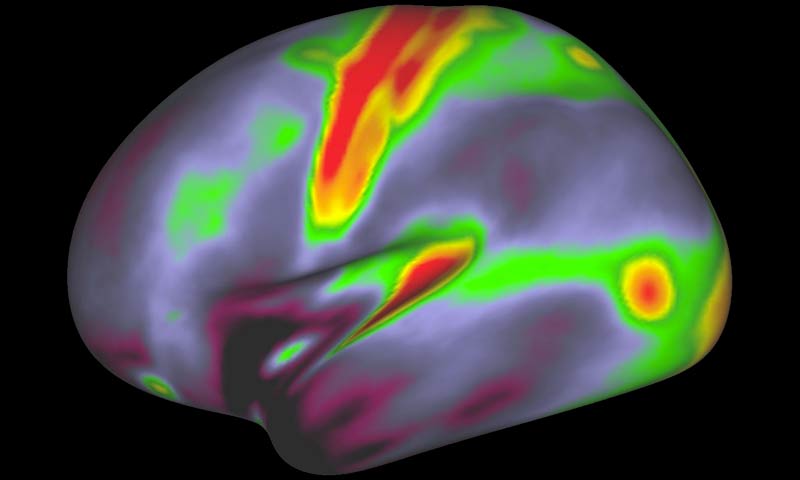 mappa dettagliata del cervello