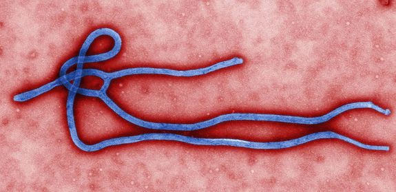 ebola-virus-che-cos-e