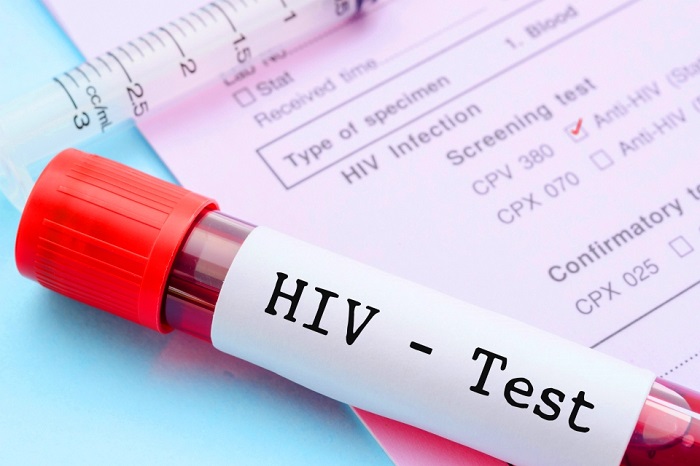 aids autotest hiv