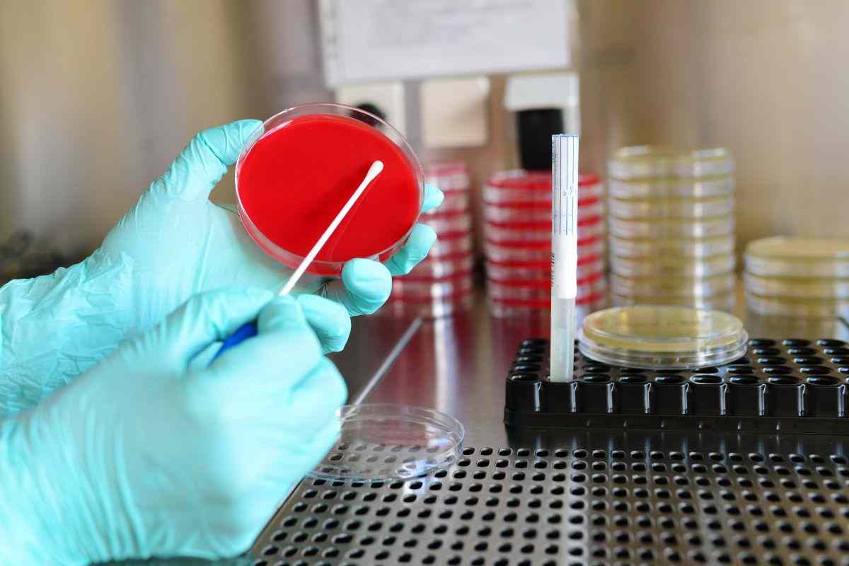 Lo usiamo tutti i giorni ma è un nido di pericolosi batteri: allarme degli esperti