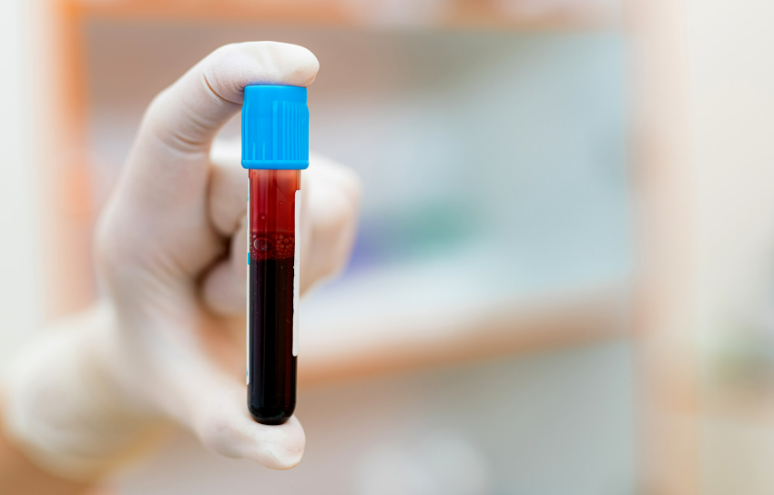 prelievo del sangue